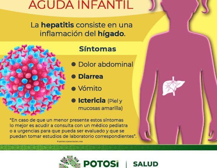  Sin casos SLP de hepatitis aguda infantil