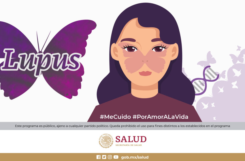  De cada 10 personas con lupus, entre siete y nueve son mujeres